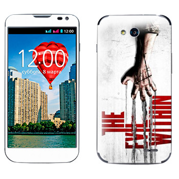   «The Evil Within»   LG L90