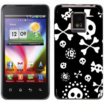   «   »   LG Optimus 2X