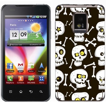   «   »   LG Optimus 2X