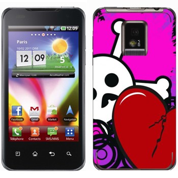   «-  »   LG Optimus 2X