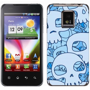   « »   LG Optimus 2X