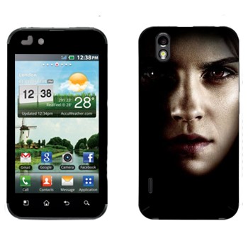 LG Optimus Black/White