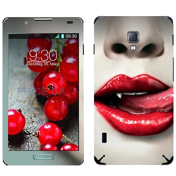   « - »   LG Optimus L7 II